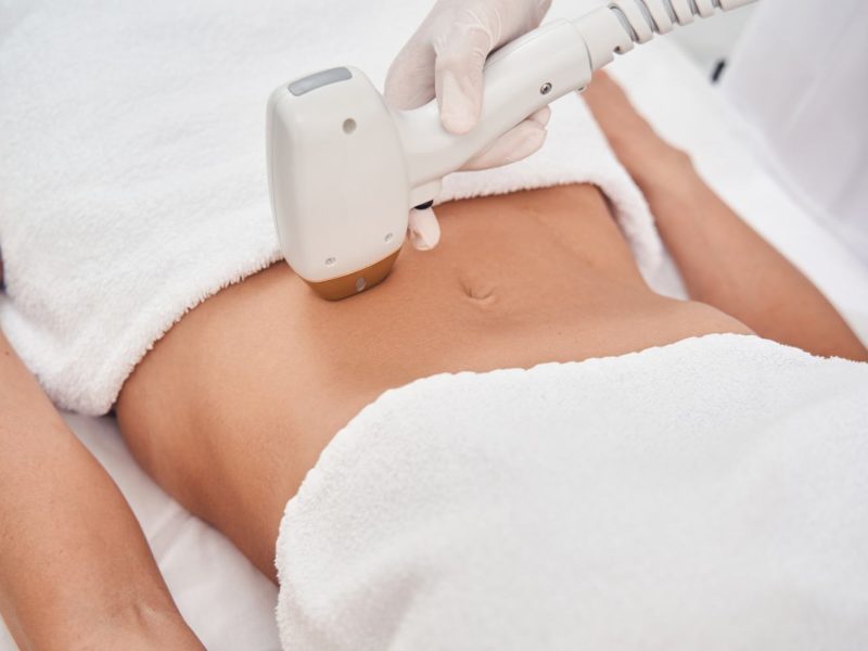 Alexandrite-Lazer-Epilasyon-Nasil-Yapilir-800x600