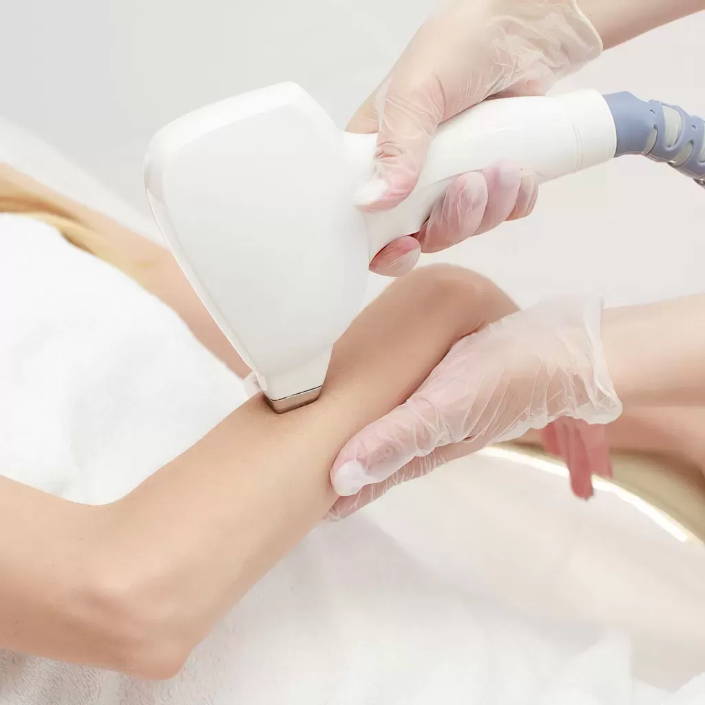 medilas_teknolojik_uygulamalar_kol_lazer_epilasyon-jpg-webp